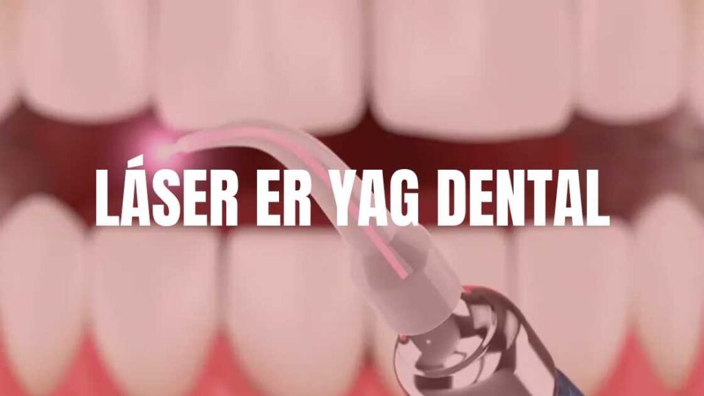 Láser Er:YAG Dental: Ventajas Y Sistema Soga | Smart4D