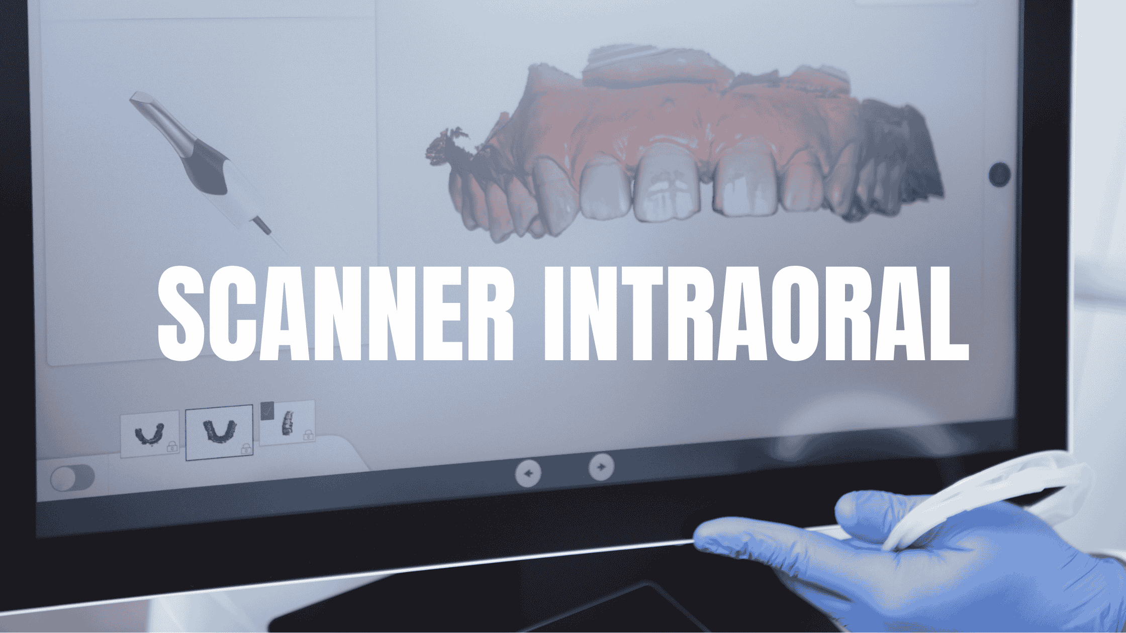 scanner intraoral (1)
